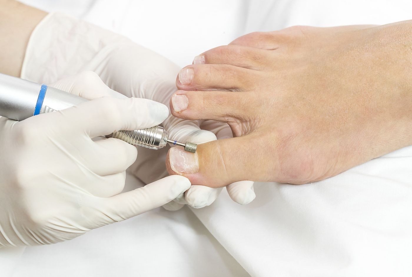 Pedicure leczniczy